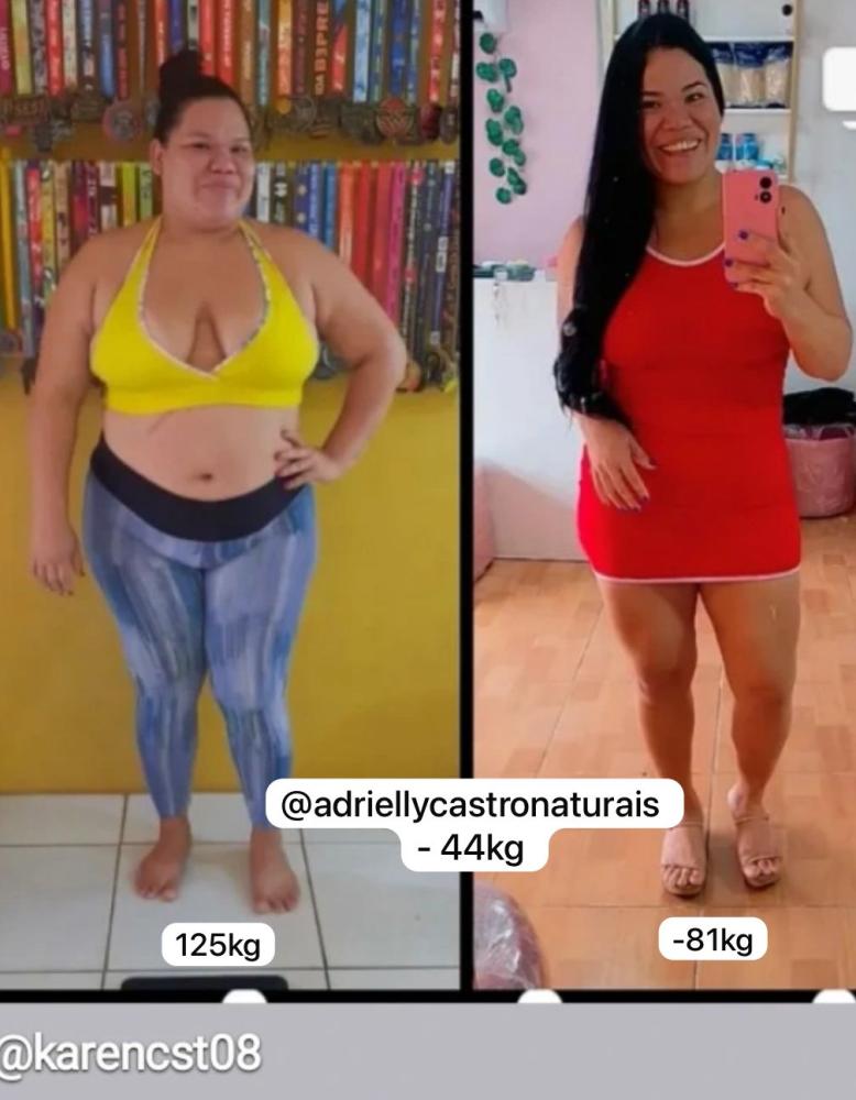 Transformação real — Karen perdeu 44kg com a DryFit